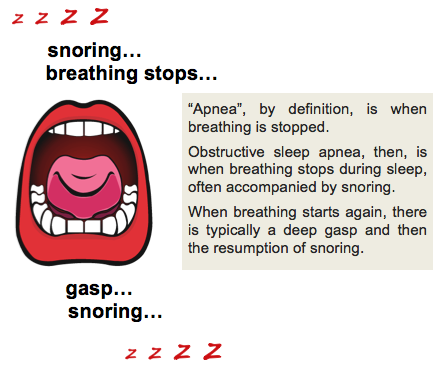 Obstructive Sleep Apnea: How To Know If You Have it?